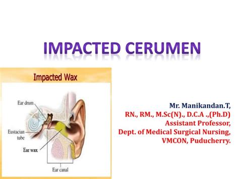 weber test with cerumen impaction|cerumen impaction procedure.